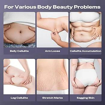 السعر 25 مع التوصيل ❤️. محل امزون القياره

هذا جهاز تدليك السيلوليت المنزلي "D-Lines B-Fat L-Skin" المصمم لتشكيل الجسم وشد البشرة. 
المميزات التقنية: يعمل بتقنيات مختلفة تشمل الاهتزاز، الحرارة (بين 37-42 درجة مئوية)، وتيارات دقيقة (Microcurrent) لتحفيز العضلات. 
أوضاع التشغيل: يحتوي على 3 أوضاع رئيسية: تقليل الخطوط (D-Lines)، حرق الدهون (B-Fat)، وشد البشرة (L-Skin). 
مستويات الكثافة: يتضمن 10 مستويات للسرعة أو الكثافة لتناسب الاحتياجات المختلفة. 
المواصفات: جهاز قابل للشحن عبر كابل Type-C وبطارية بسعة 1200 مللي أمبير.


**إذا كنت صاحب هذا الإعلان وتريد حذفه لأي سبب، رجاءا أرسل رسالة إلى الدعم الفني**