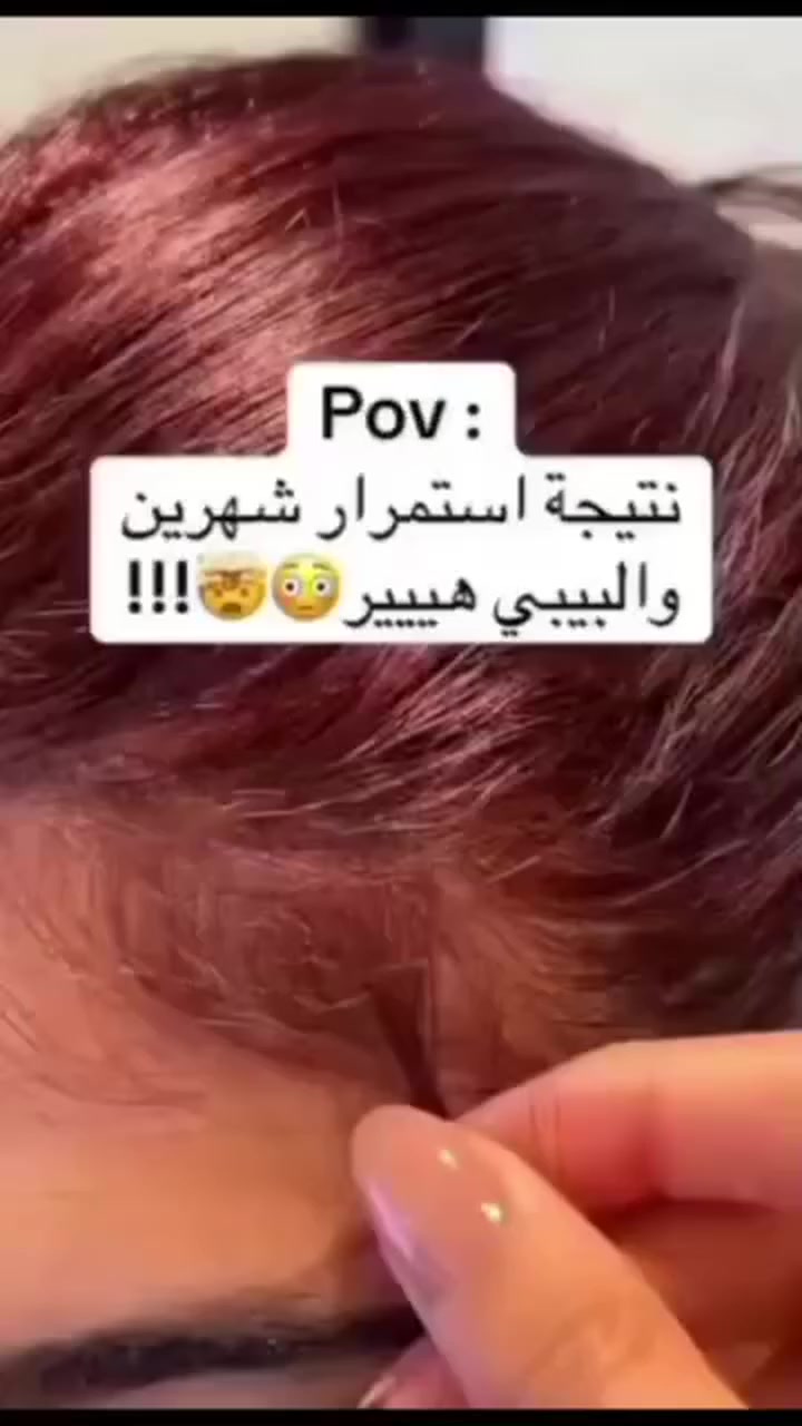 متابعة وكومنت ليوصلك السعر 💌
زيت إكليل الجَبل والنعناع الأصلي متوفر مع توصيل مجاني ضمن سوريا 🤍


**إذا كنت صاحب هذا الإعلان وتريد حذفه لأي سبب، رجاءا أرسل رسالة إلى الدعم الفني**
