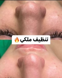 تنظيف عادي • تنظيف ملكي • عرض الأربعاء والخميس