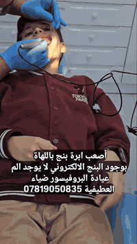 أصعب ابرة بنج باللهاة  بوجود البنج الالكتروني لا يوجد الم عيادة البروف...