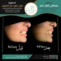 ⁨ ⁨ 🦷 الدكتورة حنين المنصوري- عيادة الدكتور مصطفى كمال  أجهزة متطورة و...