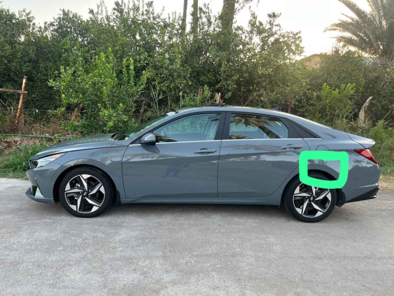 الانترا سمنتي مديل 2023  رقم بغداد لمتد فول فول مواصفات حادثها موضح بالصور  بدون دواخل بدون ايرباك بيها بالقمارة مال تحميل وهلال الجاملغ الخلفي بارد ماشيه ٧٢ الف 
مكان بغداد الكرخ حي الاطباء 
السعر 165$ 
رقم الهاتف ***********
