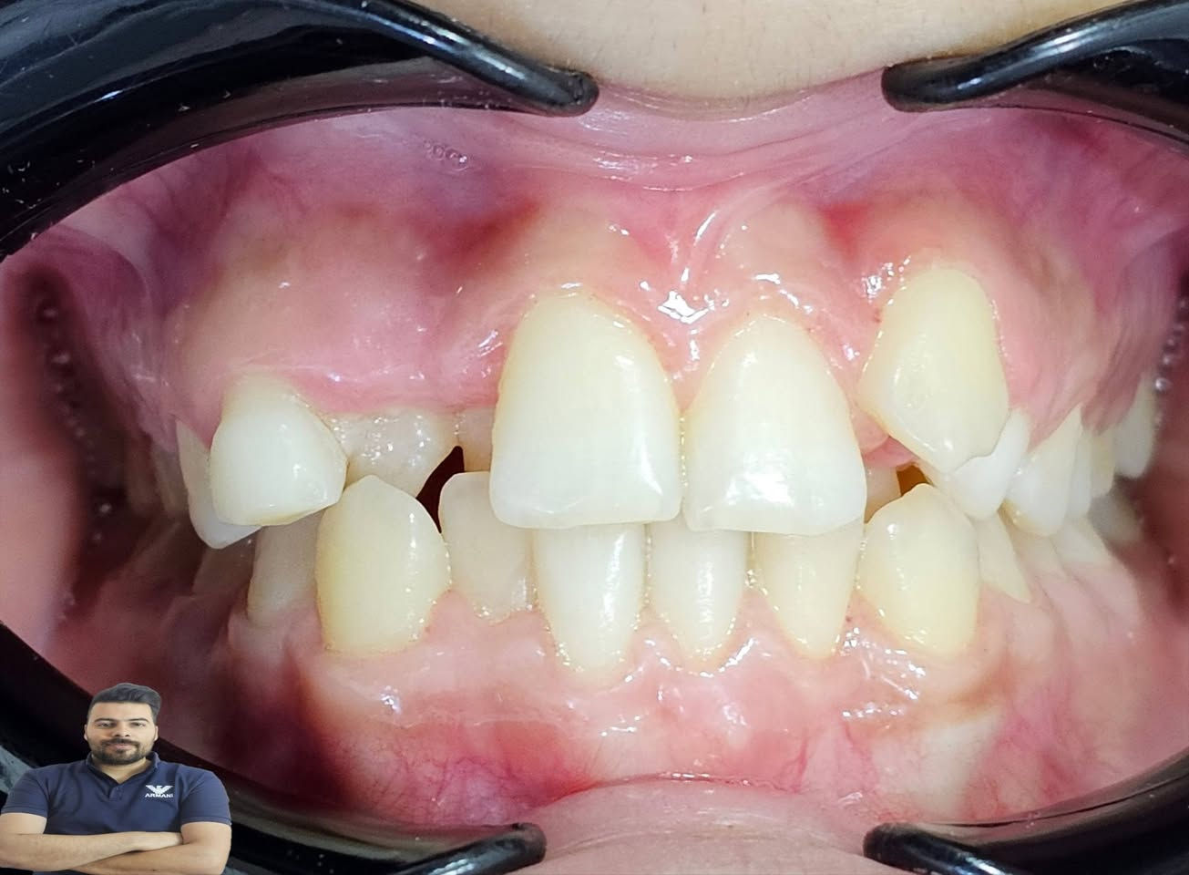 فاطمة اجتنة عدها اسنان لبنية وعدهة سن مطمور ضاحك وعدها الناب الدائمي صاير بالمقدمة وسنين اماميات راجعات ليورة خلال سنة وثلاث اشهر كدرنة نحل اغلب هاي المشاكل 

العنوان / المسيب / شارع البلدية / مقابل دكتور جعفر وفي للاطفال مجاور عالم الحليب

للحجز والاستفسار 
***********
***********
