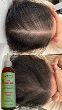 زيت اكليل الجبل • يمنع التساقط • OSCAR GMS