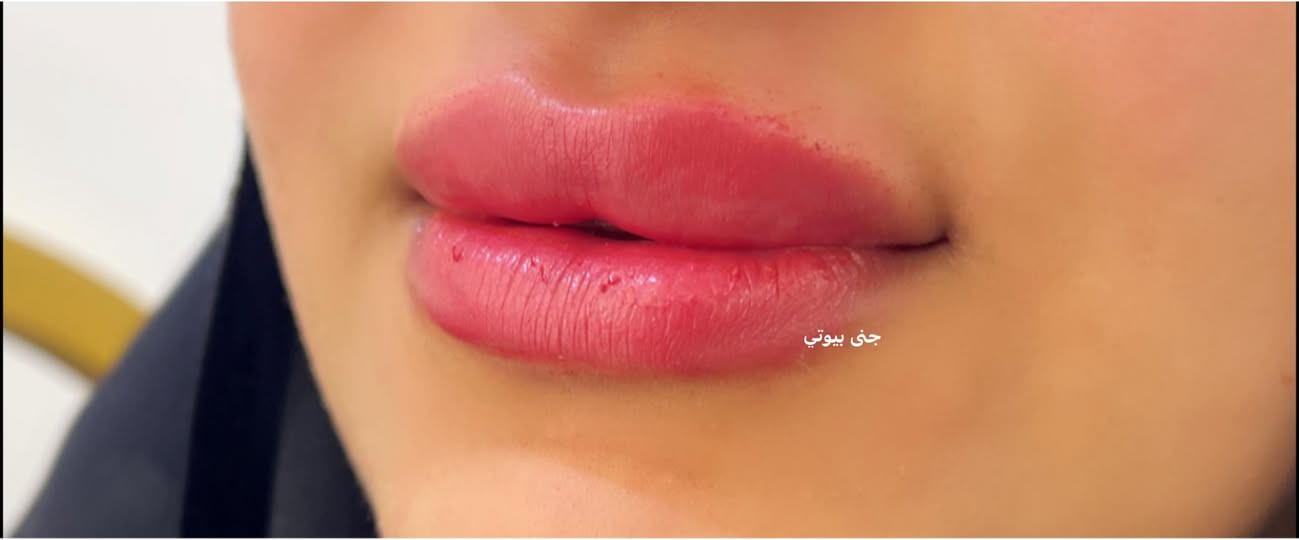 الجميله من كربلاء حقنا الشفاه قبل سنتين 
واليوم جددنا الحقن💉💉
💋💋


**إذا كنت صاحب هذا الإعلان وتريد حذفه لأي سبب، رجاءا أرسل رسالة إلى الدعم الفني**