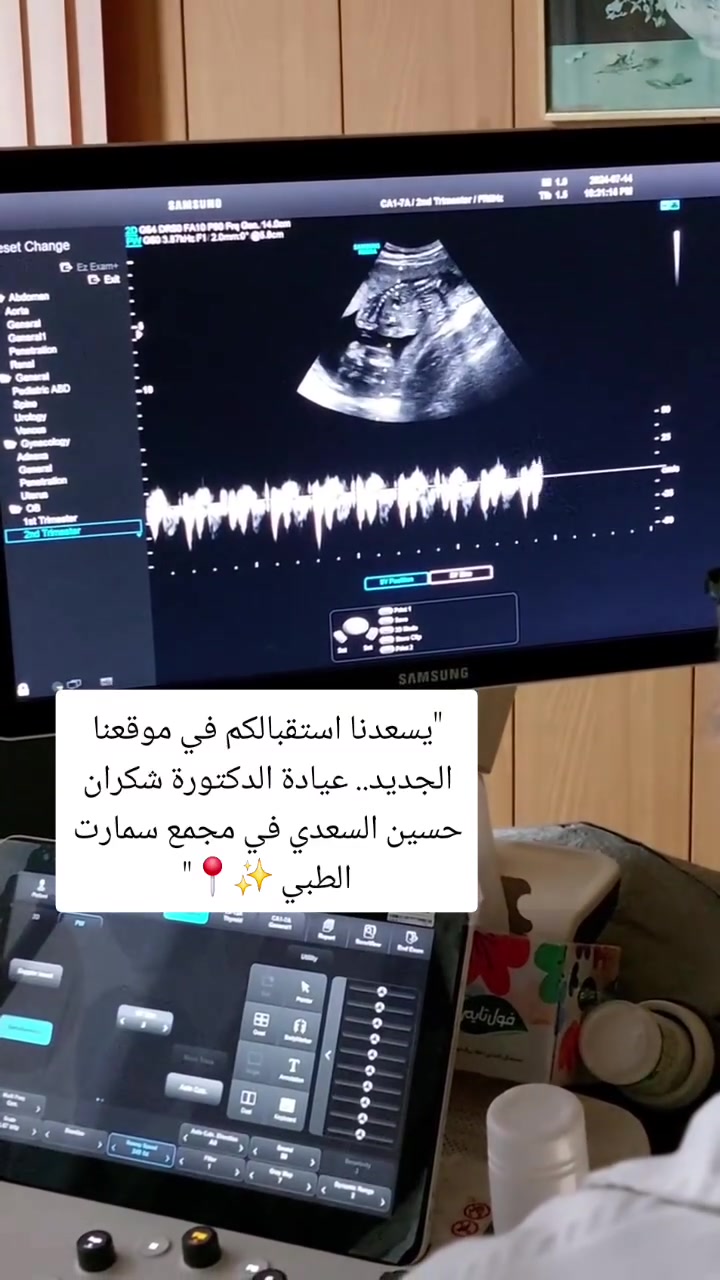 لأن كل نبضة قلب داخلكِ.. هي بداية لرحلة أمومة نعتني بها 💖
​لكل مراجعاتنا العزيزات في طوز، يسعدنا أن نعلن لكم عن انتقال عيادة الدكتورة شكران حسين السعدي (اختصاص الأمراض النسائية والتوليد والعقم) إلى موقعها الجديد والوحيد في المدينة لتقديم رعاية أقرب وأجمل لقلوبكم:
​📍 مجمع سمارت الطبي / طوز - الجمهورية - نهاية شارع حسن قوان (قرب معرض حجي جاسم).
​نستقبلكم بكل حب لنستمر معاً في رحلة الاطمئنان على صحتكِ وصحة جنينكِ بأحدث التقنيات وأعلى معايير العناية.
​🗓️ أيام الدوام: الأحد - الثلاثاء - الخميس.
⏰ الوقت: يبدأ الدوام من الساعة الرابعة والنصف مساءً.
​📞 لترتيب موعد زيارتكِ والحجز المسبق: ***********
(أو تواصلوا معنا مباشرة عبر رسائل الصفحة)
