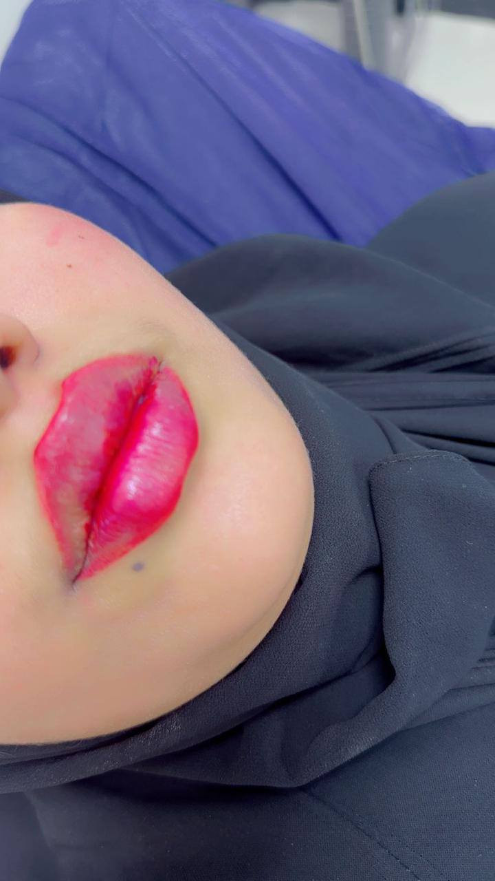 عياده الدكتورة شذى عبد الأمير   مسويتلكم عروض💖 عل فيلر ✨ بمناسبة الفلنتاين ✨
عنوان الحسينية _ عيادات الوادي النوذجية _ مجاور مطعم ابن مدلول الطابق الأرضي 

للحجز والاستفسار ***********
