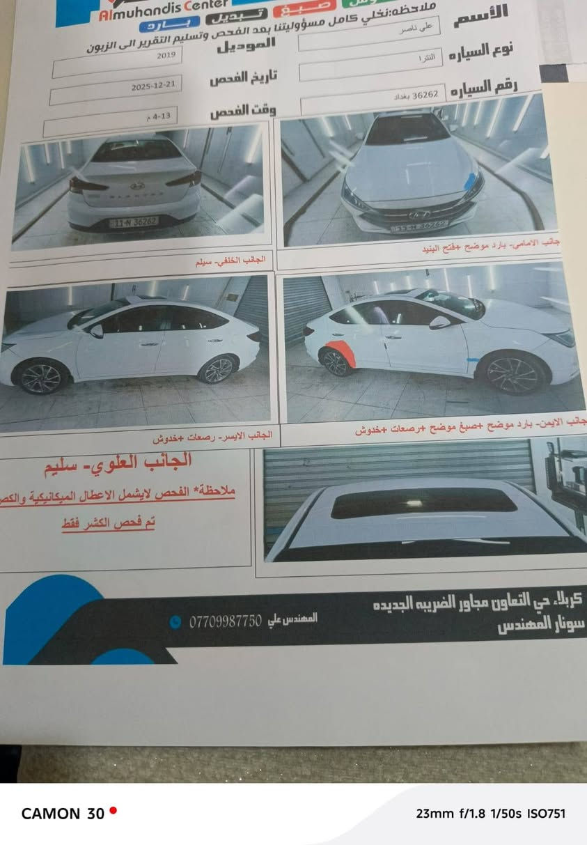 السلام عليكم
سيارة النترا موديل 19 رقم بغداد 
ماشية 30 الف كم 
مكان السيارة في كربلاء
صور السيارة مرفق معها السونار
للاتصال: ***********
ملاحظة: الرقم يحتوي على واتساب
