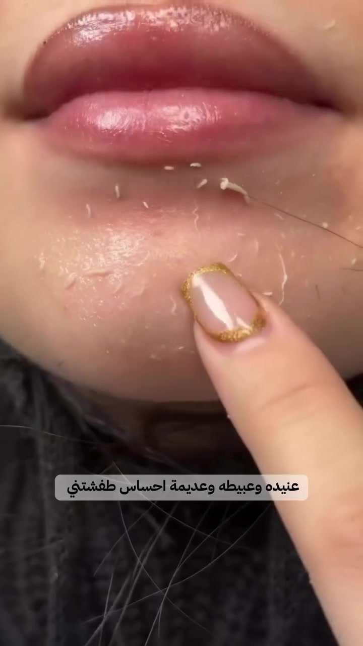 😍 اخيرررررررراً انتهيت من معاناتي مع المسام والروس السوداء #مسام #مسامات_واسعة #رؤس_سوداء #viral #explore


**إذا كنت صاحب هذا الإعلان وتريد حذفه لأي سبب، رجاءا أرسل رسالة إلى الدعم الفني**