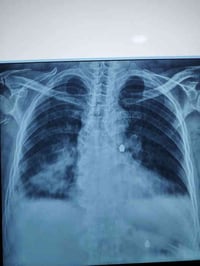 وبركاته زارتنا المريضة ز.م  البالغة من العمر ٦٧ تعاني من الام الصدر، س...