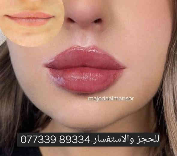 طبيعي – مظهر أنثوي جذاب
💉 جلسات فيلر شفايف بمواد أصلية وآمنة
✔️ تكبير الشفايف بشكل متناسق
✔️ تحديد الحدود بلمسة أنيقة  الدكتورة ماجدة المنصور Jojo Alnabeel
العنوان بغداد الحسينية مقابل السوق الكبير مجاور مرطبات العذراء
مجمع سما الحسينيه للحجز ***********  حساب التيك توك 
https://www.tiktok.com/@ma8j4?_r=1&_t=ZS-915uhyehfWy
