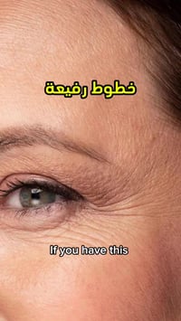 A313 ريتينول • كريم فيتامين A • تجاعيد