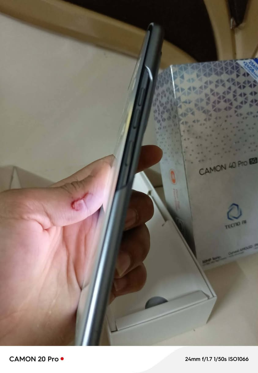40 برو 5g ذاكره 256 الرام 12+12
الجهاز نضيف شرط لا مفتوح ولا واصل مصلح انطيك بي ضمان ((فقط الفطر الي بلمس فوك ماماثر ولا بي اي شي ))) الجهاز كامل ملحقات الاصليه معه الكارتون العنوان موصل ايسر التواصل ***********
***********
