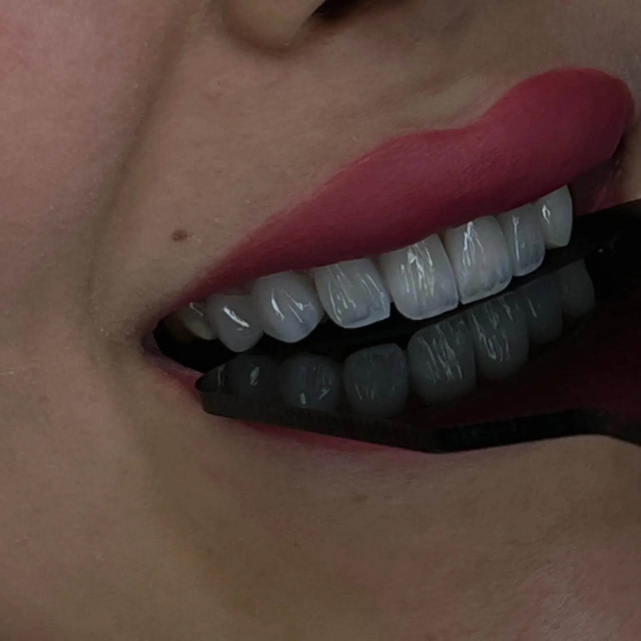 مركز ماسة الحسينية التخصصي لطب وجراحة الفم والأسنان 

ابتسامة حلوة.. وثقة ما إلها حدود! 🦷❤️

📍 العنوان: بغداد - الحسينية - خلف السوق الأول - شارع 20.
📞 للحجز والاستفسار الفوري: ***********
تغير الكلام
