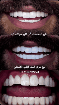 غير ابتسامتك 🪥 تغير حياتك ✔️
مع مركز اسد لطب الاسنان
***********
 @أبرز المعجبين
