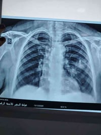 عيادة الدكتورة راحيل احمد الجنابي للامراض الصدريه والتنفسيه    #الاشعة...