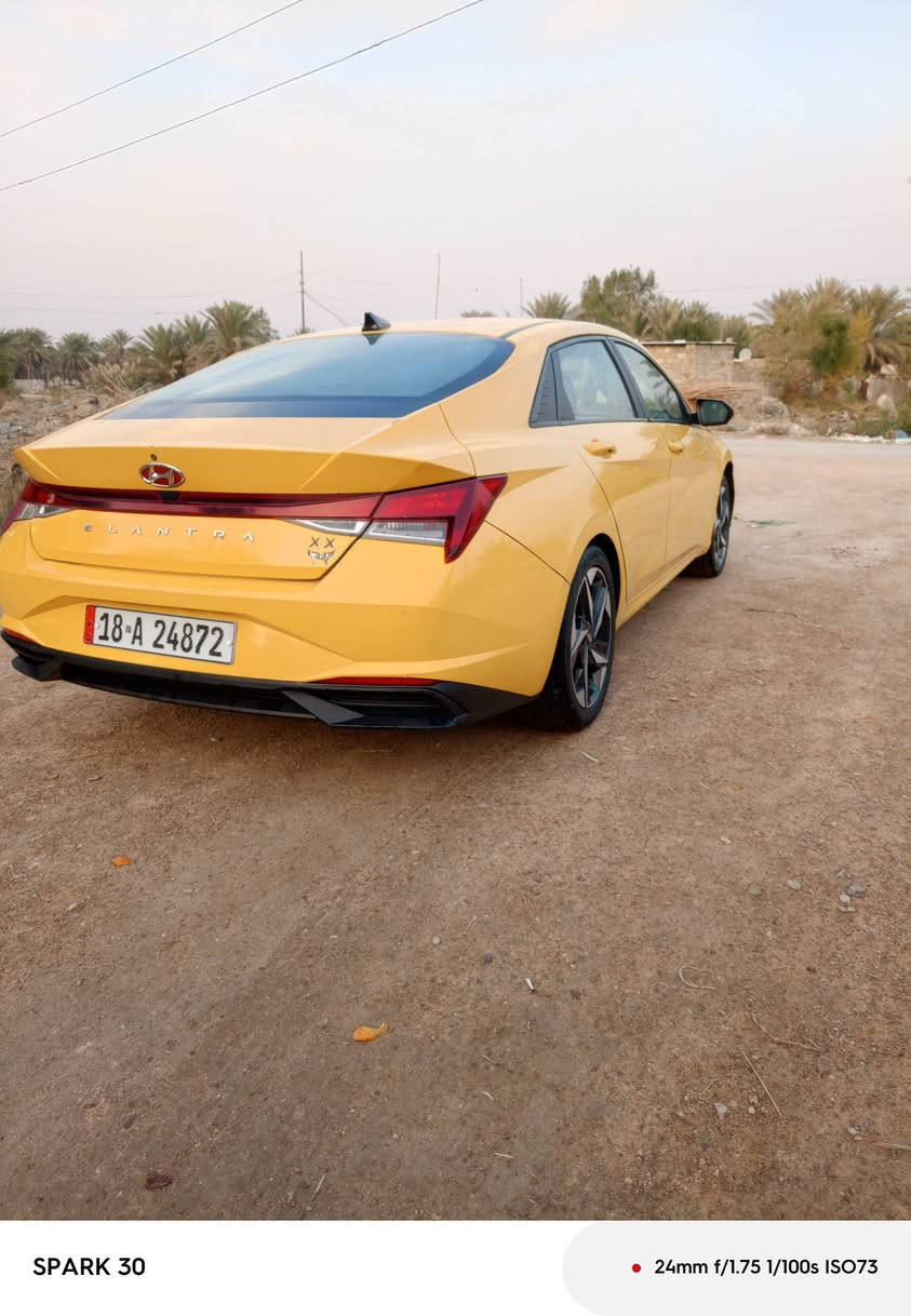 سلام عليكم النتره البيع موديل 21 حادثه بنيد فقط بدون دواخل فول مواصفات حساسات خلفيه حساسات امامي
حساسات جانبيه بيه بعد مواصفات كلش حلوه  منضومه غاز 
معروضه 155 بيه مجال بصيط مكان السده الهنديه هاذا رقمي ما متواجد على فيس ***********
