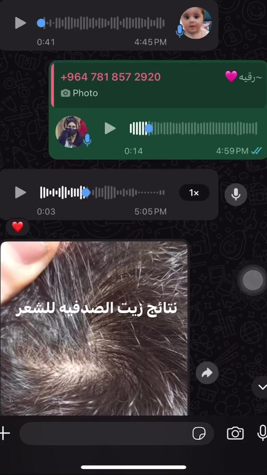 عشبه النيم و تلقب  صيدلية القرية (The Village Pharmacy): هذا هو اللقب الأشهر لها، لأن سكان القرى في الهند يعتمدون عليها منذ آلاف السنين لعلاج معظم الأمراض الجلدية والصحية اليومية. #البصره #الهند #بغداد 


**إذا كنت صاحب هذا الإعلان وتريد حذفه لأي سبب، رجاءا أرسل رسالة إلى الدعم الفني**