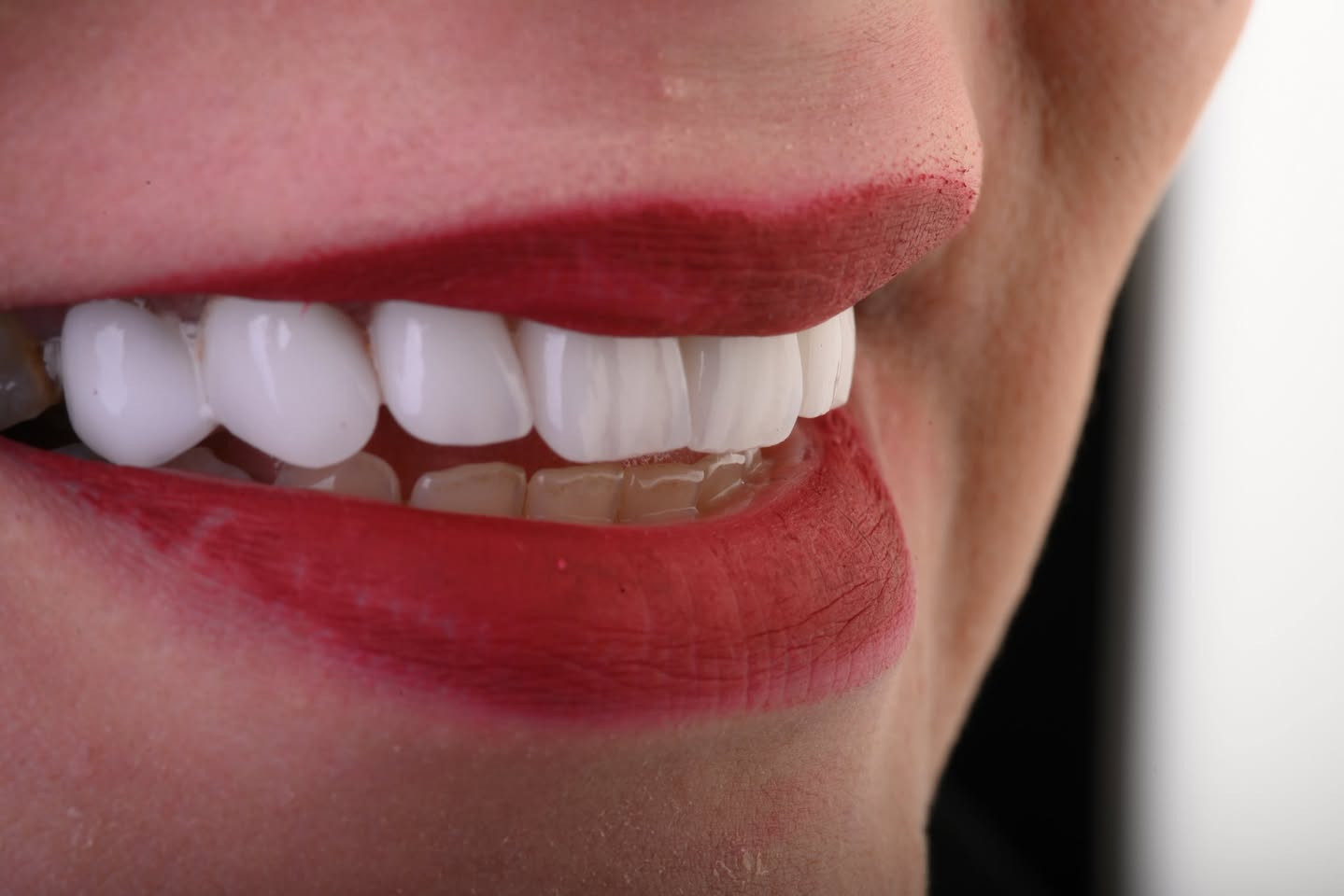 تركيب اسنان 🦷 - د. موسى محمود الكعبي 
📍شارع الاطباء - مركز سومر - الطابق الثاني - مقابل صيدلية موسى مولان 

احجز موعدك الان 📞***********
