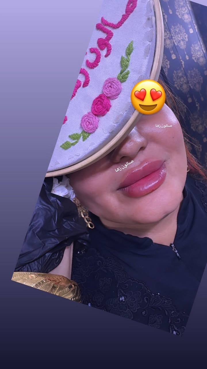 عرض بكج أميرات صالون زها 

جلسه نضاره مع فلر اودري تغير شامل 12 سيسي ب 200 الف فقط 
جلسه نضاره مع فلر اودري تغير شامل 6 سيسي ب 100 الف فقط 
جلسه نضاره مع فلر اودري تغير شامل 3 سيسي ب 50 الف فقط 

جلسه نضاره مع فلر ابتك تغير شامل 10 سيسي ب 400 
جلسه نضاره مع فلر اراستي تغير شامل 10 سيسي ب 600
جلسه نضاره مع فلر سويسري تغير شامل 10 سيسي ب 800 

فلر شفه اودري ب 25 
فلر شفه ابتك ب 50 
فلر شفه اراستي ب 75 
فلر شفه سويسري ب 100 
فلر شفه الايطالي ب 150 

فلر شفه مع وجنات مع جلسه نضاره ب 75 الف فقط

جلسه نضاره مع تنظيف البشره ب 25 
جلسه نضاره مع تنظيف البشره ب 50 
جلسه نضاره مع تنظيف البشره ب 75 
جلسه نضاره مع تنظيف البشره مع مكس كامل ب 100 
جلسه نضاره مع تنظيف البشره مع مكس كامل ب 125 
جلسه نضاره مع تنظيف البشره مع مكس كامل ب 150 
تفاصيل الجلسات نشرحه الكم بعد المعاينه وننصحكم بالشي التختاروا واليفيدكم

للحجز والاستفسار واتساب *********** ادمونه زهراء
