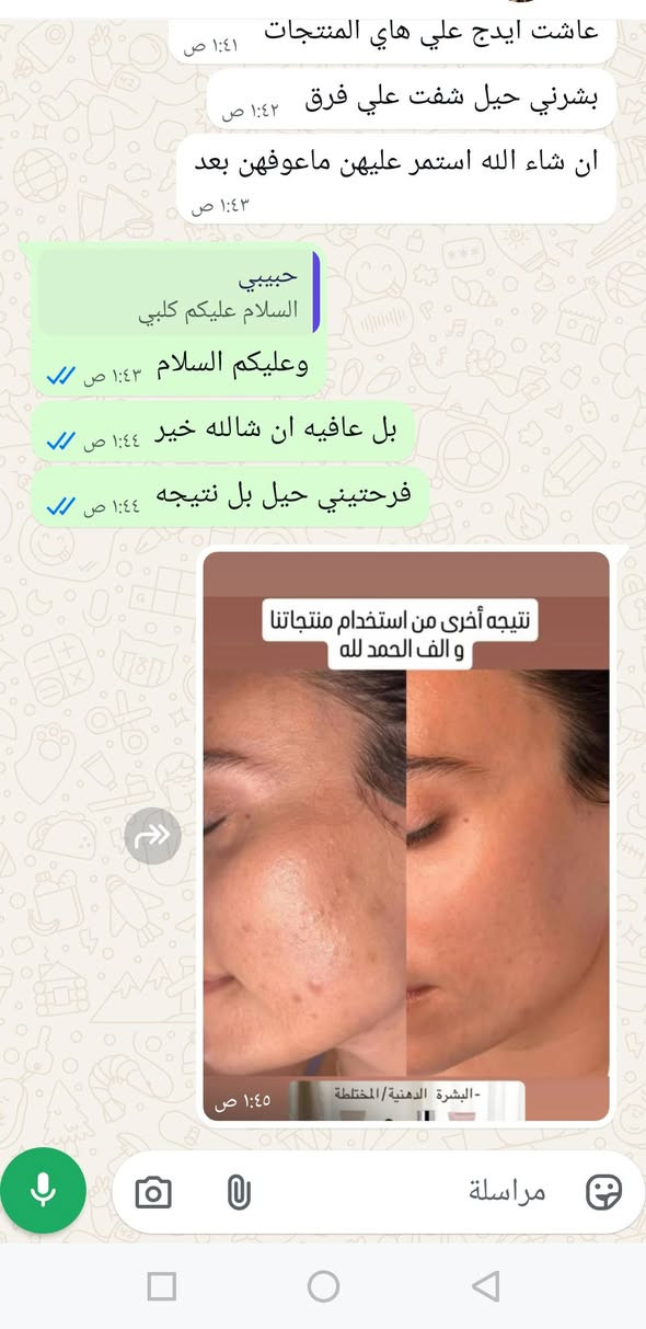 الحمدلله علي نعمته بفضل الله كل ماي داتكثر النتايج الزباين البيج دار الجمال


**إذا كنت صاحب هذا الإعلان وتريد حذفه لأي سبب، رجاءا أرسل رسالة إلى الدعم الفني**
