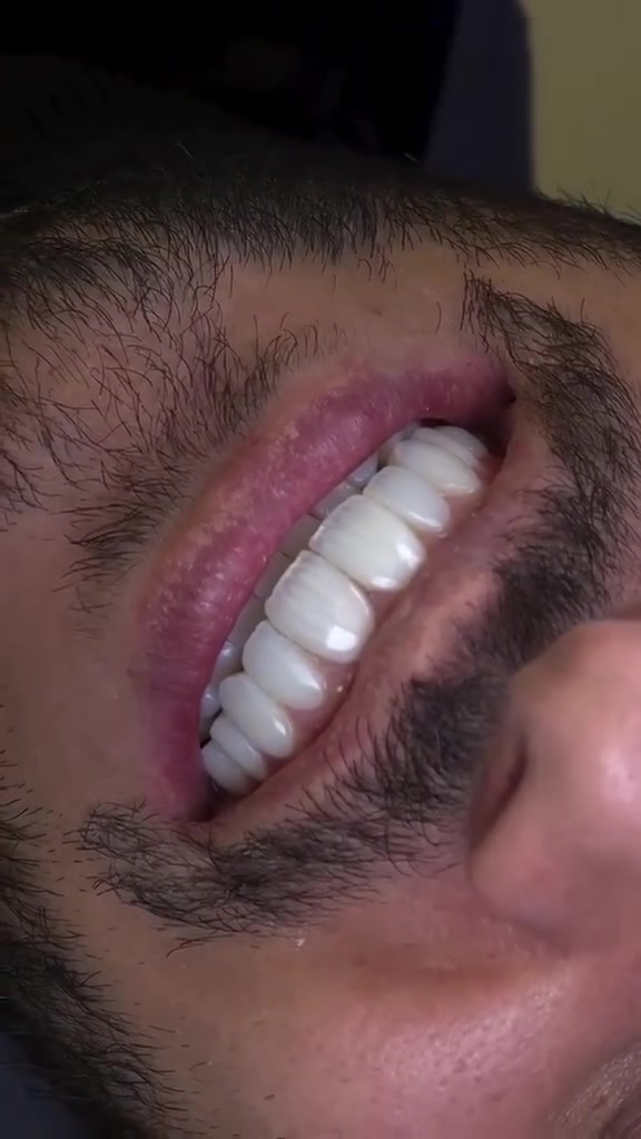 "🦷 أسنان أكثر إشراقة ويا مراكز الشركة الطبية 

في مراكز الشركة الطبية العالمية ، نوفر لك أحدث تقنيات طب الأسنان، وأسهل طرق الدفع.

✅ تقويم الأسنان ✅ تبييض الأسنان ✅ ابتسامة هوليوود
زراعة أسنان 
وحشوات وكتير من الخدمات 

متواجدين داخل المركز طيلة أيام الأسبوع لخدمتكم 

  #عيادة_اسنان #طب_اسنان #كي_كارد #KeeCard #دفع_الكتروني تقويم_اسنان تبييض_الاسنان زراعة_الاسنان ابتسامة جمال صحة

العنوان : طويريج _الشارع العام_مجاور نقابة المعلمين _مقابل المكتبة العامة _مجمع الحارث الطابق الثاني 

رقم الهاتف ***********
  ***********
