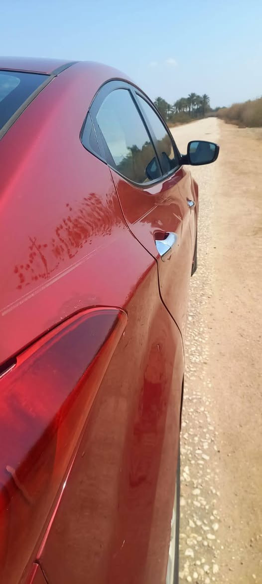 مكينه 1800

حادثه جاملغ الايمن بدون دواخل

رقم انكليزي 

السياره امريكيه حداديه امامي خلفي جديد 

سياره كامل المواصفات عده الفتحه والبصمه 

مكاني كربلاء طويريج 

الرقم *********** ،***********

هاذه الرقم اليتصل بيه خير ويدلل
