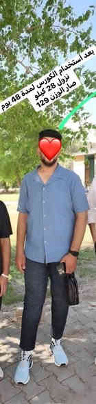 ضايج من وزنك ؟؟
دتحلم بجسم ووزن مثالي وتحسه صعب 
ويانا ماكو  شي صعب أنت تحلم وأحنى نحققلك أحلامك 
وبكل أمان وبمتابعة على  مدار 30 يوم 
نسويلكياها سفرة يوم أجمل من يوم
🔻🔺
ويانه إطمئن وأحلم بالوزن اليعجبك
وإحلامك أوامر 
💥  صيدلية شارع 40 💥

#للحجز_أو_الأستفسار_يرجى_مراسلة_البيج
#او_الواتساب🩵***********🩷
العنوان:بابل-حلة-شارع 40 -بداية -باب الحسين-مقابل-دائرة-الكهرباء-ومجاور-BDC-مول 
توجد خدمة توصيل لكل محافظات العراق
@أبرز المعجبين
