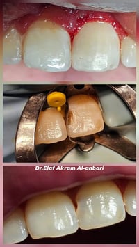 ابتداءاً من يوم الاحد راح ترجع العيادات التعليمية لجامعة الهادي تفتح ن...