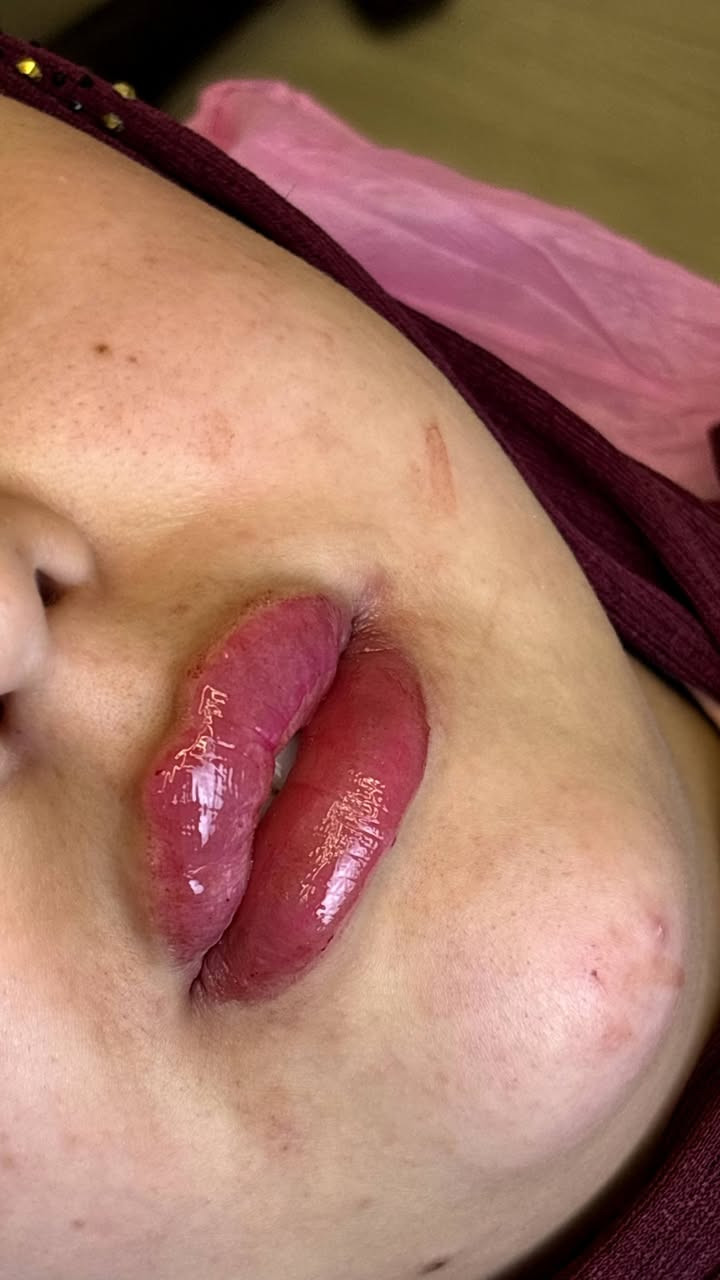 ‏✨شغلي بالتجميل مو بس مهنة✨…هو فن🥰
‏يبرز جمال كل وحدة بطريقة ناعمة ومميزة.😍
‏أهتم بأدق التفاصيل، لأن الجمال الحقيقي يكمن في البساطة والإتقان.
‏#عيادةالدكتورةنبأمكي 😍
‏لطب وتجميل وزراعة الأسنان🦷
‏والحقن 💉والتجميل اللاجراحي🩹💉
‏احجزي موعدك وخلي جمالك يحكي لكِ 🤍
‏
‏📍العنوان_الأعلام شارع البدالة_ مجمع القمة الطبي
‏☎️ ***********
‏
