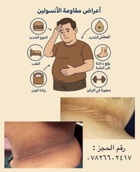 مقاومة الانسولين • خطة غذائية • كربلاء/طويريج