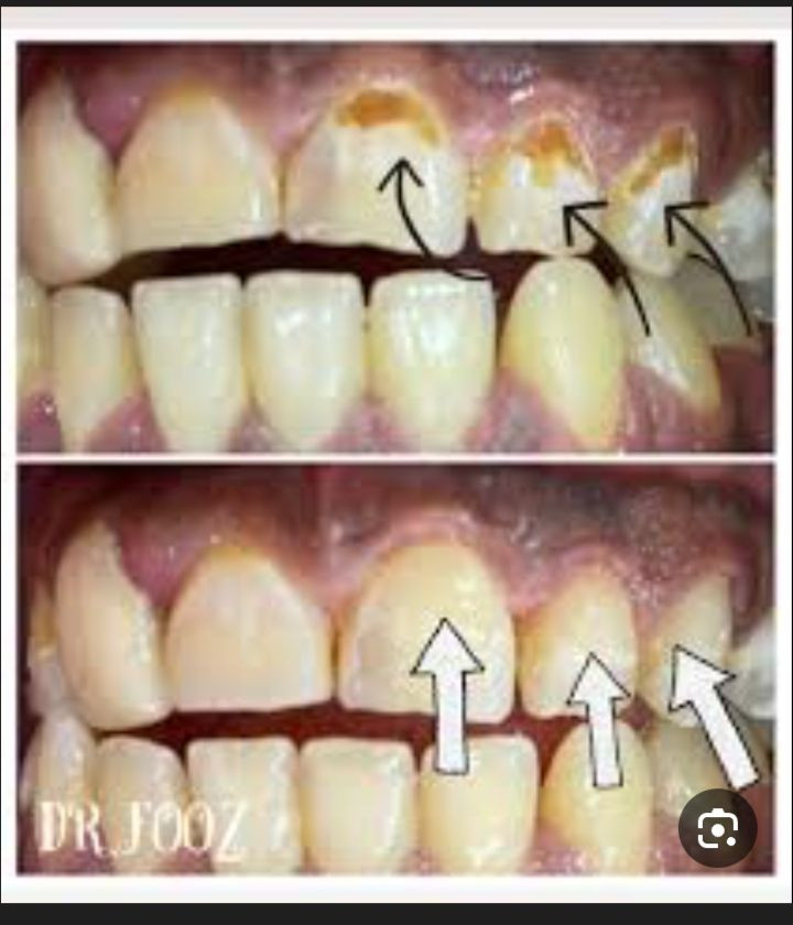 السلام عليكم 
الي عنده مثل هيج تسوس يتواصل وياي والعمل مجاني 
للتواصل ارسل رساله ع واتساب 
***********
