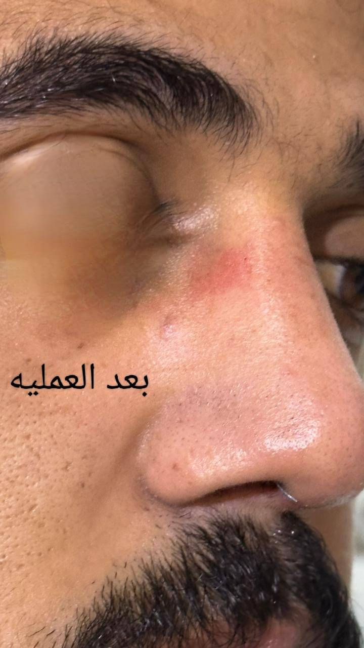 اليوم الجمعة #مساءً باذن الله
متواجد الدكتور #مجيد_يوسف مجيد 
طبيب اختصاصي بورد في جراحة الأنف والأذن والحنجرة
حالات نزلات البرد والاحتقان والرشح
مشاكل الفقرات العنقيه 
 في مجمع مدينتي الطبي ناحية العباسي مقابل الملعب 
***********.   ***********
