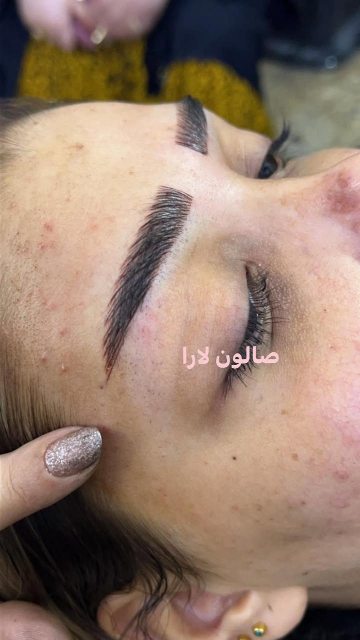 عروض التاتو راس السنة 🌲🌲

تاتو فايبروز 25 
تاتو مايكرو بليدنج 25
تاتو 6D(سكس دي) 25
تاتو ابلوك 25 
شادو حاجب 25 
سحب لون 25 
مسح بمادة الريجوفي 50 
مسح ليزر 25 
توريد شفه 20 
تحديد شفه 10
  صالون لارا لكل سيدة انيقة العنوان:
بغداد البلديات شارع الأمن
العامة مقابل صرف البركة 
💃💃💃💃
للاستفسار اتصل على
*********** #فلر_شفايف
