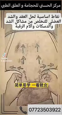 #مركز_الحسني_للحجامة_والعلق للرجال و النساء  07723503922 بغداد/زعفراني...
