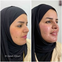 عروض العيد • انستا dr_zaineb_m • تواصل
