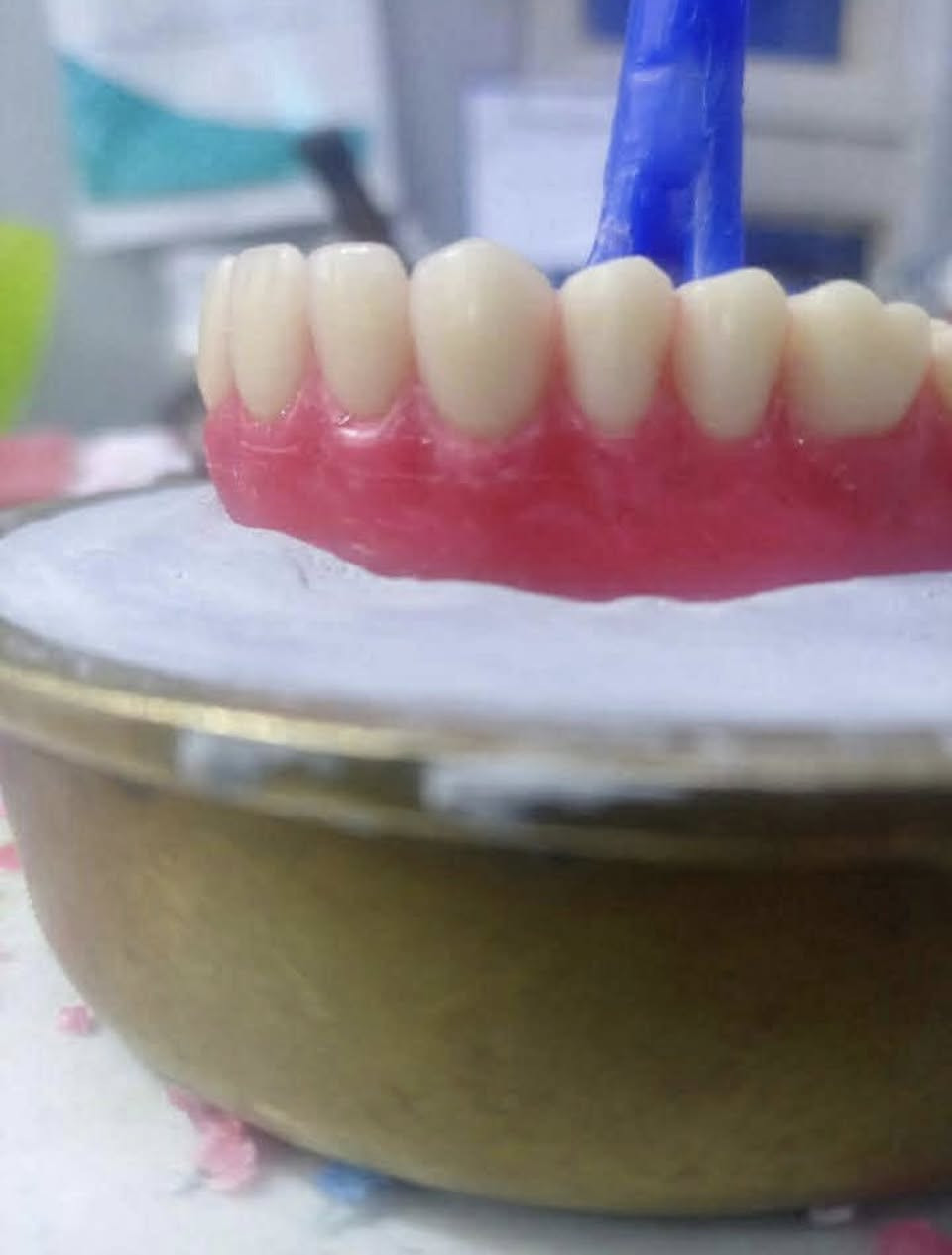 الان في #الخالص
🦷 مختبر التاج الأبيض لصناعة الأسنان👑

نقدّم لكم خدمات مخفضة  في مجال صناعة وتركيب الأسنان بأعلى معايير الدقة والجودة

خدماتنا تشمل:
▫️ تركيبات ثابتة ومتحركة
▫️ أطقم كاملة وجزئية
▫️ زيركون وسيراميك بمظهر طبيعي وجودة عالية

✔ نحرص على تقديم عمل متقن يدوم طويلاً
✔ إمكانية التقسيط الشهري
✔ تخفيضات خاصة لفترة محدودة

📍 الموقع:
سوق الخالص – قرب المستوصف القديم – مقابل صيدلية البتول
(فوق أزياء وكوزمتك الغدير)

📞 للاستفسار والحجز:
***********

📲 تابعونا على إنستغرام:
@whitecrown_dent_

مختبر التاج الأبيض… دقة في العمل، وابتسامة بثقة
