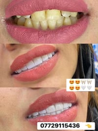 ابتسامة زراكون • عيادة ام العظام • للفكين