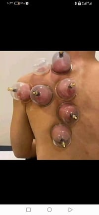 حسين السراي  حجامه أولى وحاصل على شهادة الامتياز بالحجامه 07805006784