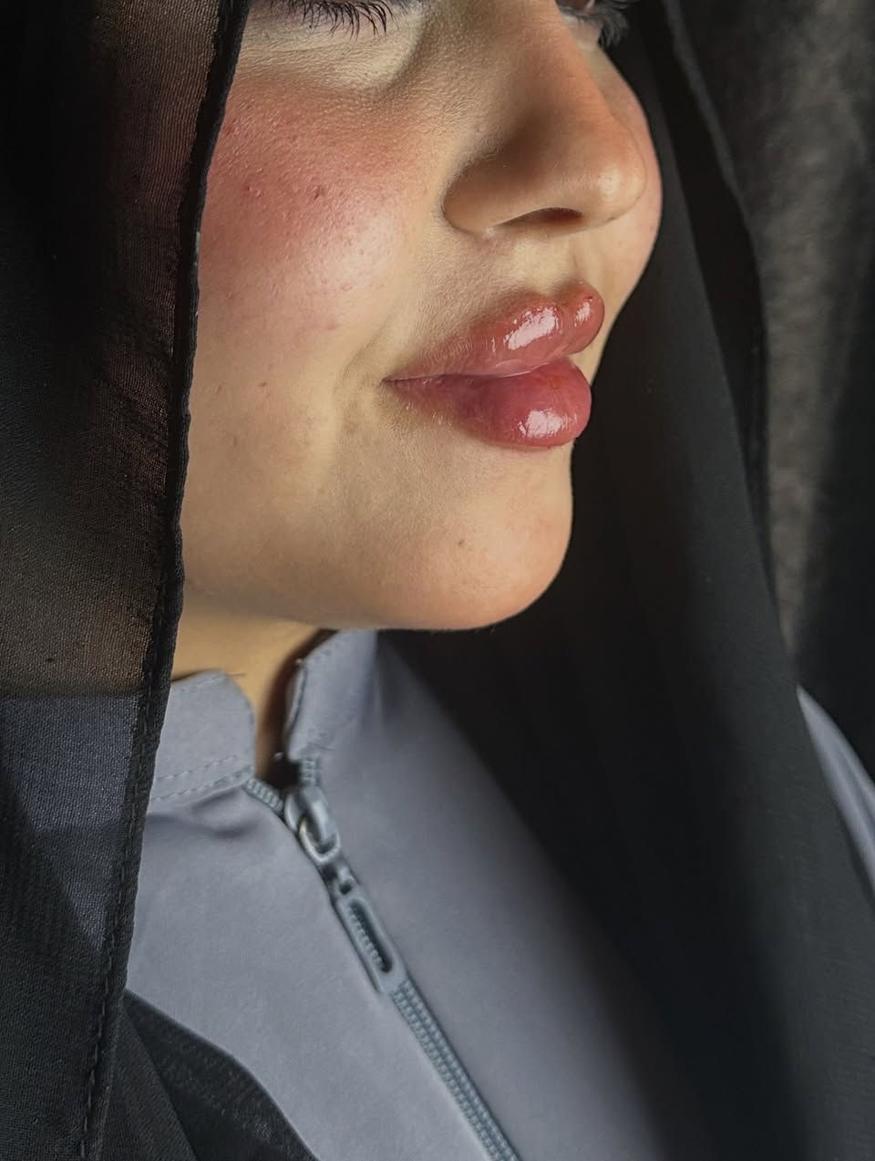 اكو احلى من هيج جمال بالحقن🙂‍↔️🔥🔥
الدكتورة ساره عدنان 💉
للحجز والاستفسار الاتصال المباشر للرقم :***********
