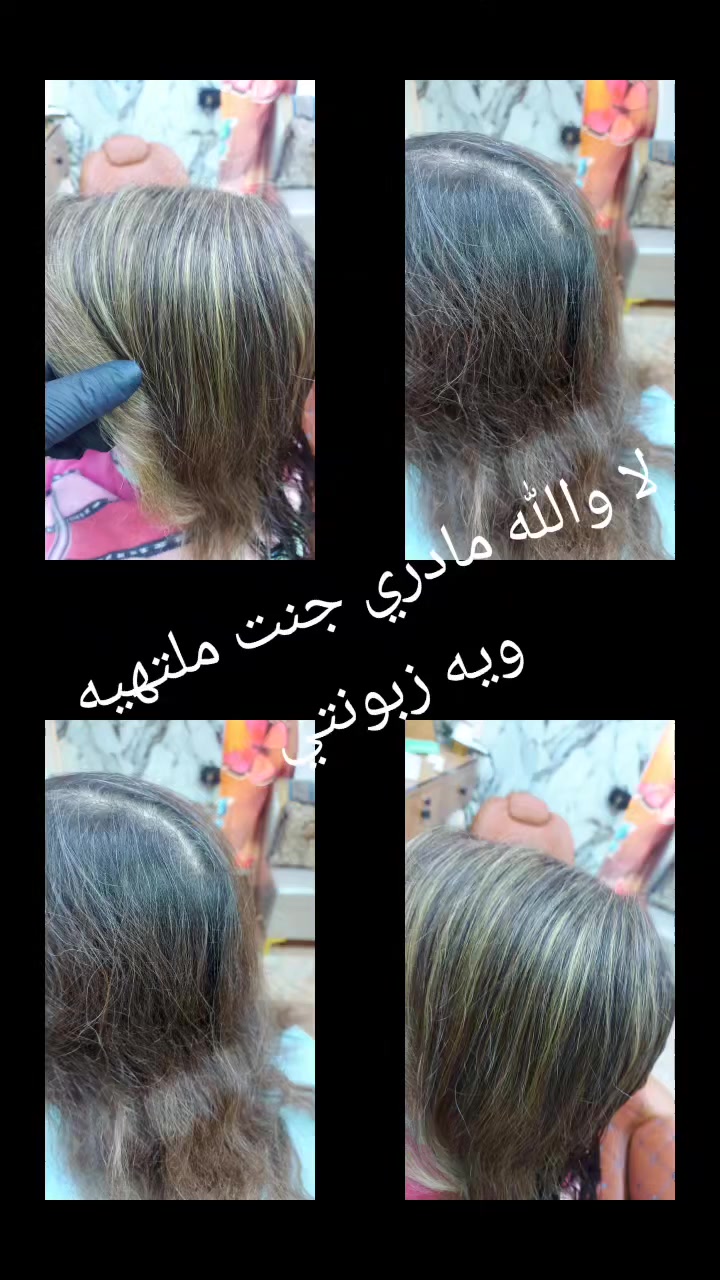 صبغ وميش ٣٥ فقط ستغلو لفرصه بنات حي لنصر فرع لمثلجات قمر لعشيره وهلا وغلا بيكم


**إذا كنت صاحب هذا الإعلان وتريد حذفه لأي سبب، رجاءا أرسل رسالة إلى الدعم الفني**