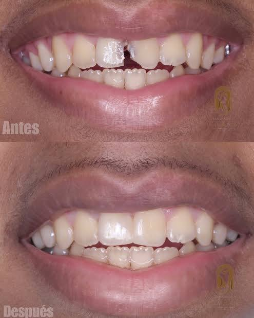 السلام عليكم 
حشوات امامية مجانا للاسنان مكسورة او متسوسة 
مكان شارع فلسطين جامعة المصطفى تواصل خاص او واتساب على رقم ***********
