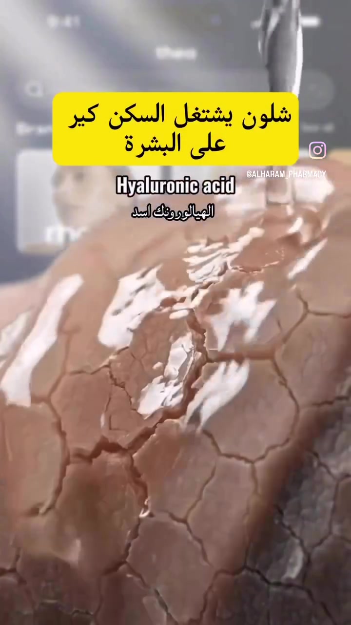 حبيباتي  كيكاتي  💗استخدام سكن كير يغنيج عن جلسات تنظيف في المراكز  البشرة اشوية عناية واصيرين تلمعين لمع ✨✨ #عناية #اكسبلور #محافظات #الشعر #اكسبلور
اي استفسار مراسلة دايركت 📩


**إذا كنت صاحب هذا الإعلان وتريد حذفه لأي سبب، رجاءا أرسل رسالة إلى الدعم الفني**