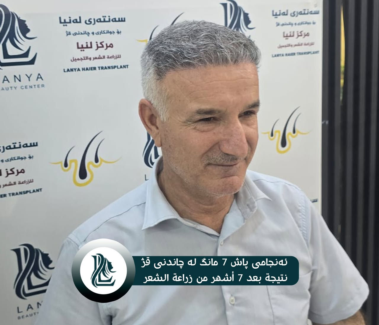 "لأن شعرك سر جاذبيتك، أعد له الحياة مع خبراء لـنـيـا."
🔹 نتائج زراعة الشعر ممیز والفريدة من نوعها تظهر دائمًا في مركز لەنیا .
♦  مع لەنیا حافظ على شبابك.
📍 العنوان:كلار - شارع ليوا - قرب جامع بخاري
📞 رقم التواصل:
***********
🔸🔸🔸🔸🔸🔸🔸🔸🔸🔸🔸🔸🔸🔸
🌿قژی چڕتر، ڕووخسارێکی جوانتر 🌿
چاندنی قژ لە لەنیا، هەنگاوێک بۆ دڵنیایی و جوانی زیاتر.
🔹 ئەنجامی چاندنەوەی قژی بێ وێنە و ناوازە هەموو کات لە سەنتەری لەنیا دەبینرێت 
♦ لەگەڵ لەنیا هەمیشە بەگەنجی دەمێنێتەوە 
📍  ناونیشان: کەلار- شەقامى لیواکە - نزیک مزگەوتی بوخاری
📞  ژمارەی پەیوەندی: ***********
