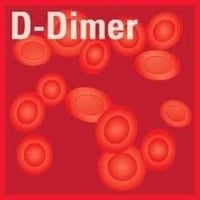 دي دايمر • مختبر الحياة • القصيرين