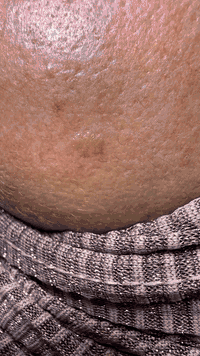 عيادة جلدية • تجميل وليزر • د محمد محسن