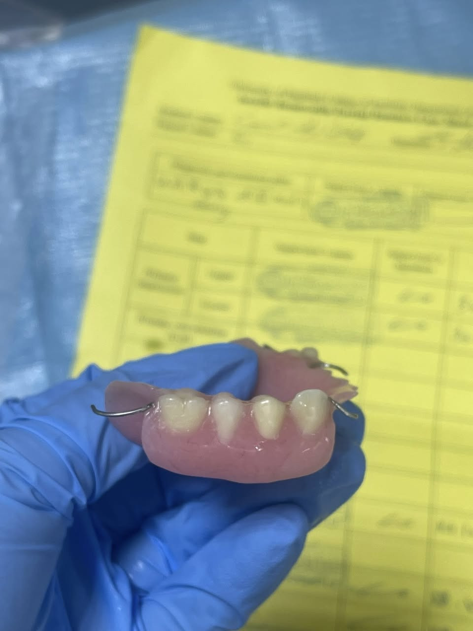 قلع وتعويضات متحركة وتنظيف اسنان تحت اشراف اطباء اختصاص 
مستشفى طب الاسنان التعليمي جامعة بغداد قرب مصرف الرافدين📍
للتواصل ***********
