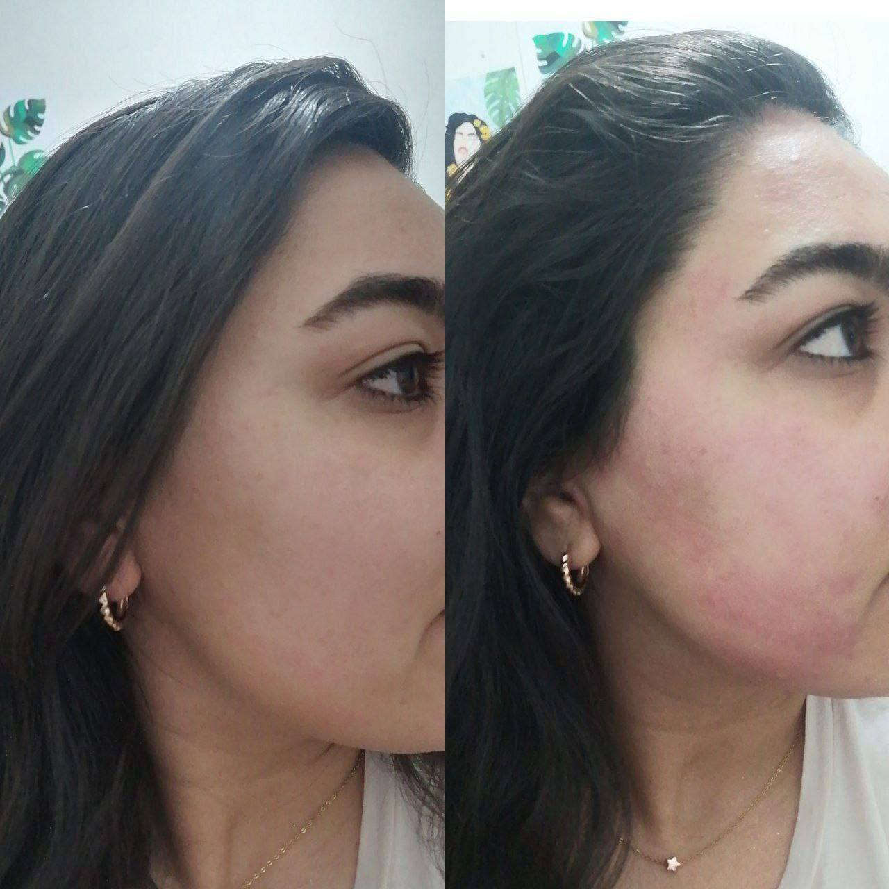 مع منتجات لدورا الأيرانيه لا تحتار
توصيل لجميع المحافظات العراق 🇮🇶
*********** واتساب 
نتائج عمل منتجات شركه لدوره 💪🔥
