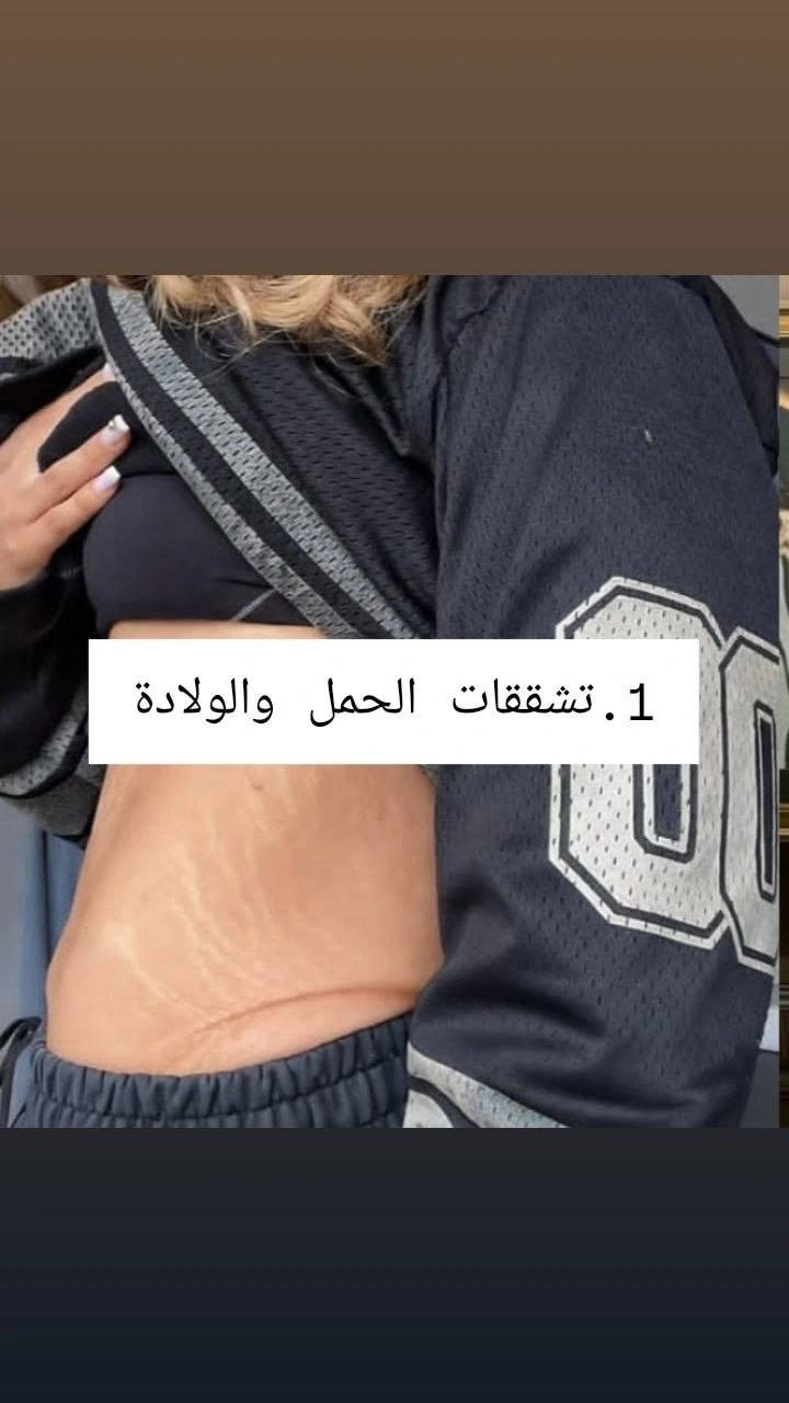 الريتنال
من سيول
حل مثالي لتشققات البيضاء
🌸🤍


**إذا كنت صاحب هذا الإعلان وتريد حذفه لأي سبب، رجاءا أرسل رسالة إلى الدعم الفني**