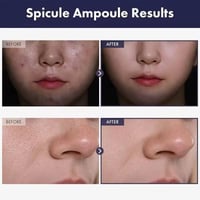 ميديكوب • إكسوسوم ٢٠٠٠ • رؤوس سوداء